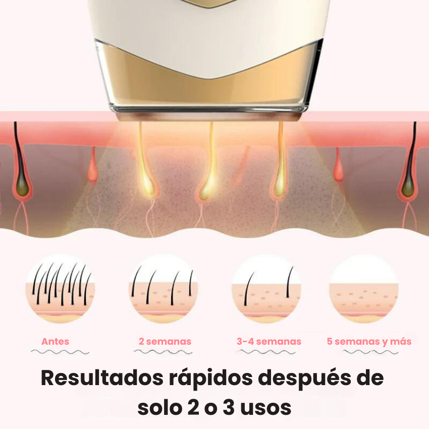Depiladora Láser  - Depilación Profesional en Casa con Tecnología Láser 🌸 Dropea